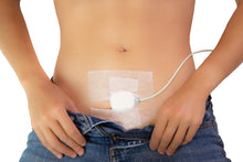 Load image into Gallery viewer, DFree - First wearable device for urinary incontinence