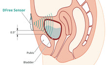 Load image into Gallery viewer, DFree - First wearable device for urinary incontinence